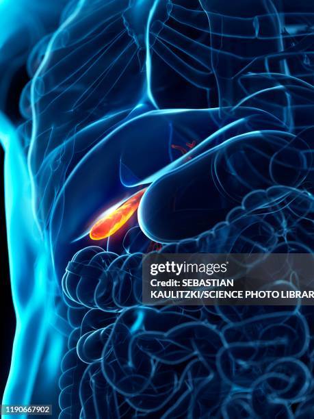 diseased gallbladder, conceptual illustration - bladder pain stock illustrations