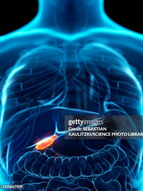 diseased gallbladder, conceptual illustration - bladder pain stock illustrations