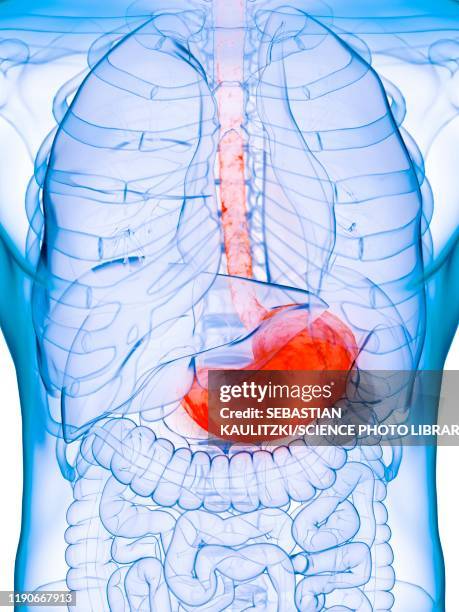 diseased stomach, conceptual illustration - ulcer stock illustrations