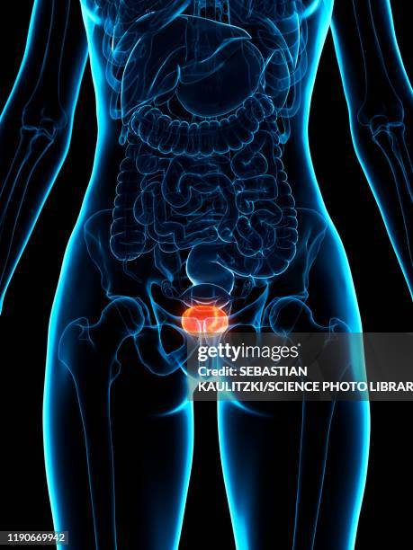 diseased bladder, illustration - bladder pain stock illustrations