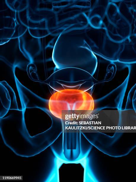 diseased bladder, illustration - bladder pain stock illustrations