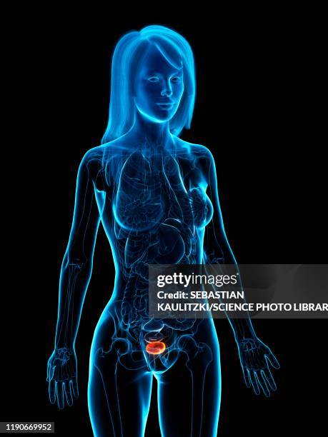 diseased bladder, illustration - female internal organs stock illustrations