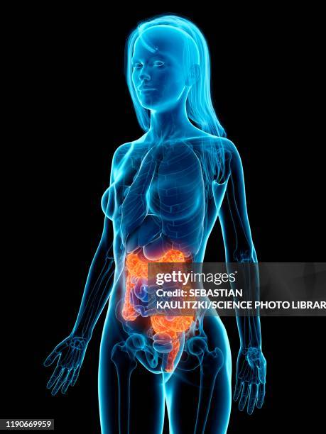 diseased colon, illustration - irritable bowel syndrome stock illustrations