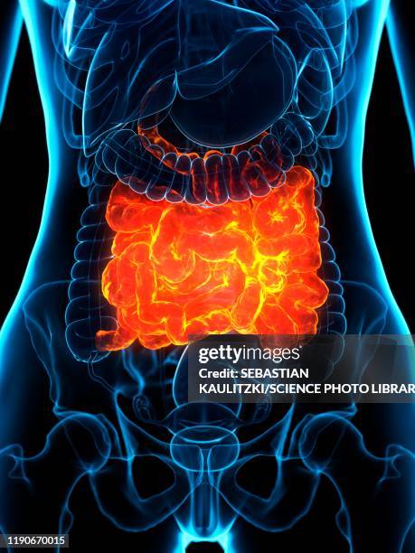 diseased small intestine, illustration - woman intestine stock illustrations