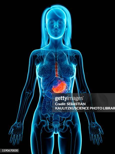 diseased stomach, illustration - refluxkrankheit stock-grafiken, -clipart, -cartoons und -symbole