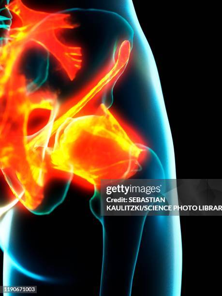 Groin Exploding 463 Groin Pain Stock Photos, High-Res Pictures, and Images - Getty Images