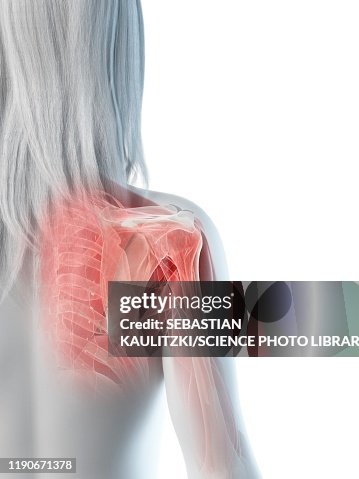 Shoulder Muscles Illustration High-Res Vector Graphic - Getty Images