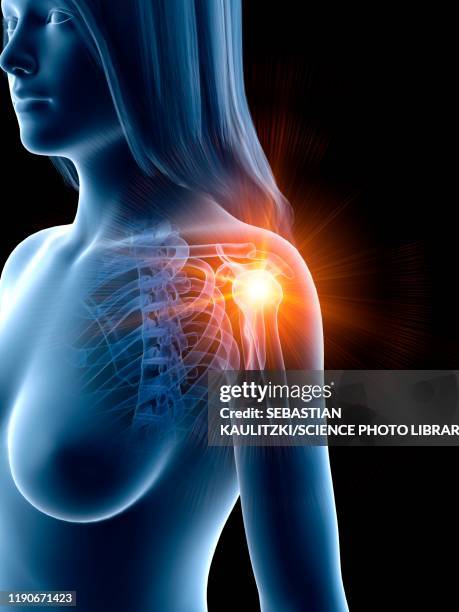 shoulder pain, conceptual illustration - shoulder pain stock illustrations