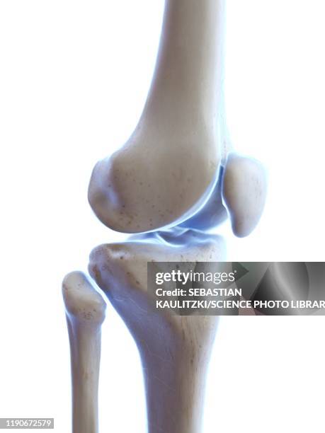 Tibia And Fibula Bones Photos and Premium High Res Pictures - Getty Images