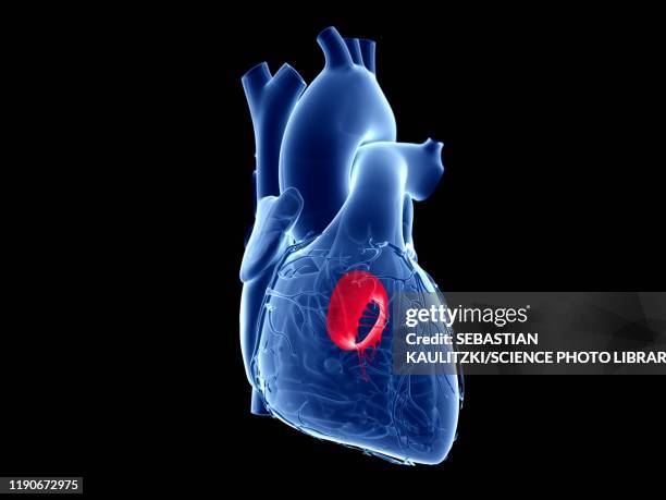 mitral valve, illustration - myocardium stock illustrations