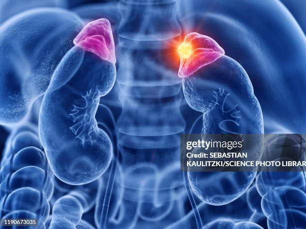 ilustraciones, imágenes clip art, dibujos animados e iconos de stock de adrenal gland cancer, illustration - cerebral cortex