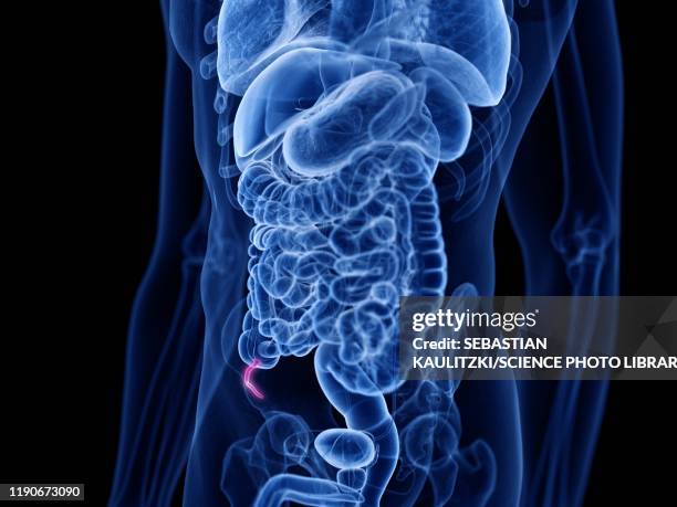 Appendix Inside 780 Human Appendix Stock Photos, High-Res Pictures, and Images - Getty ...
