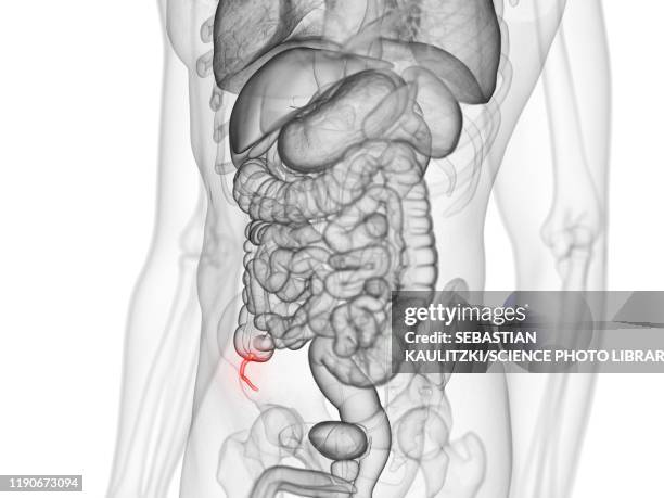 Appendix (Anatomy) Photos and Premium High Res Pictures - Getty Images