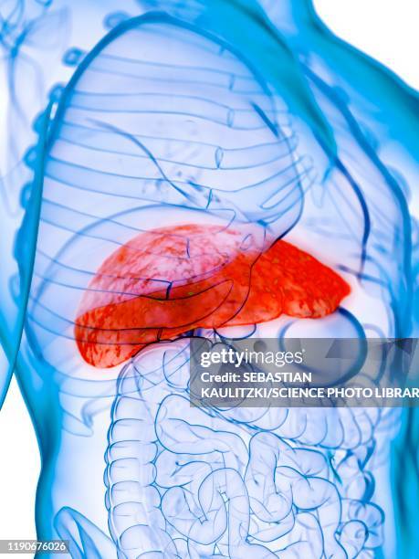 diseased liver, conceptual illustration - cirrhosis 幅插畫檔、美工圖案、卡通及圖標