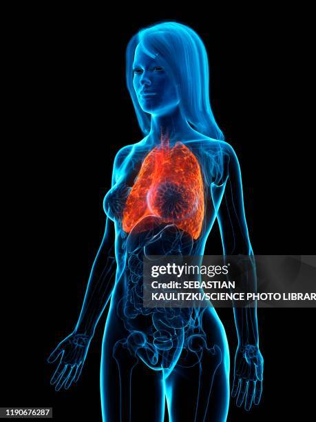 diseased lung, illustration - chronic obstructive pulmonary disease stock illustrations