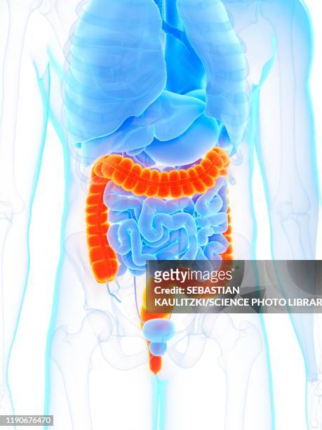 large intestine, illustration - ulcerative colitis stock illustrations