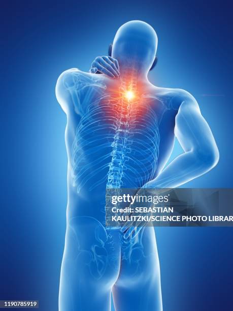 ilustraciones, imágenes clip art, dibujos animados e iconos de stock de back pain, conceptual illustration - dolor de espalda