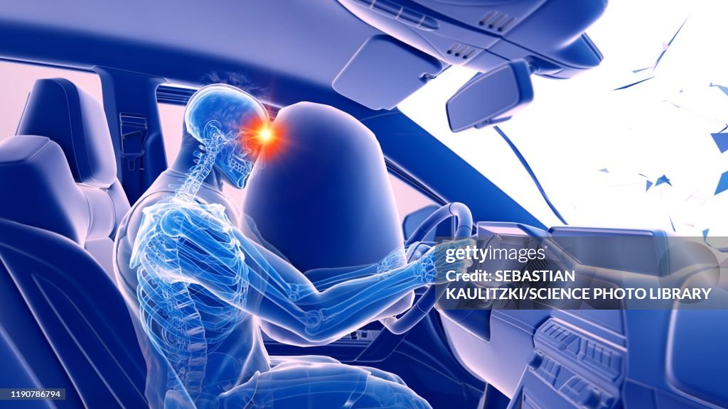 Airbag Deployed In Car Crash Illustration High-Res Vector Graphic ...
