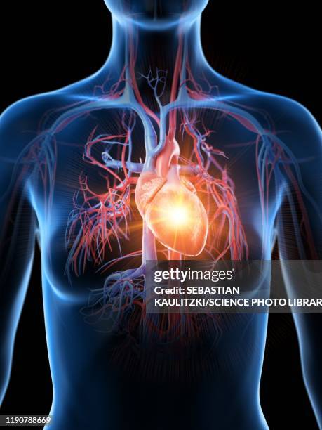 heart attack, conceptual illustration - herzinfarkt stock-grafiken, -clipart, -cartoons und -symbole