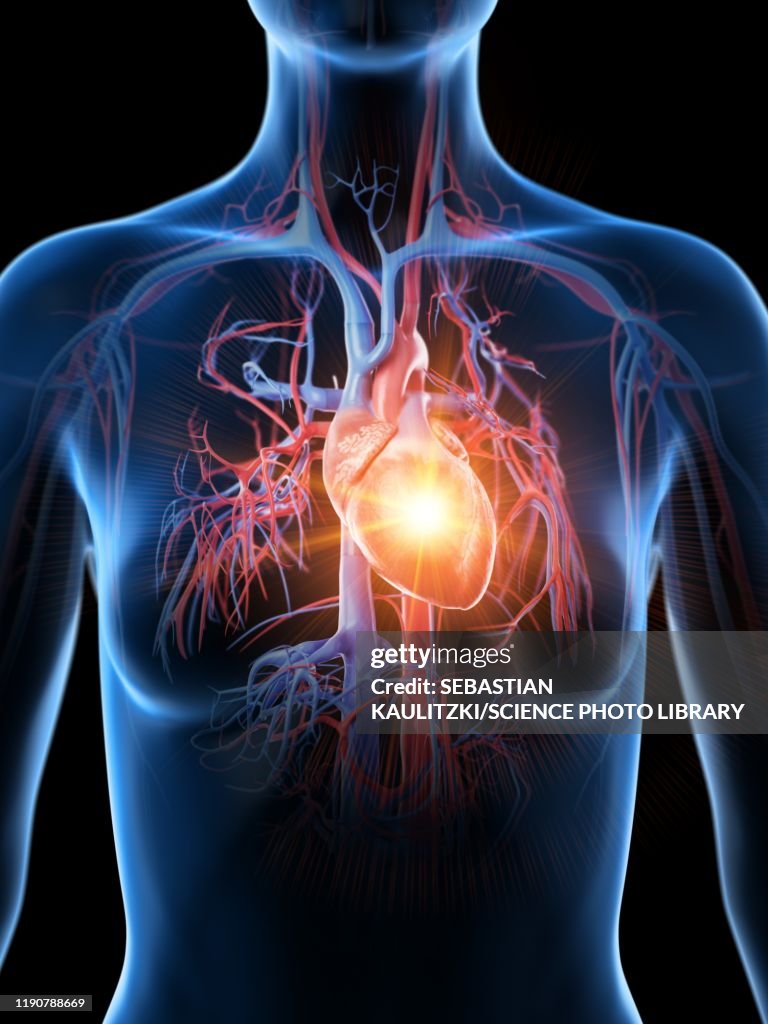 Heart attack, conceptual illustration