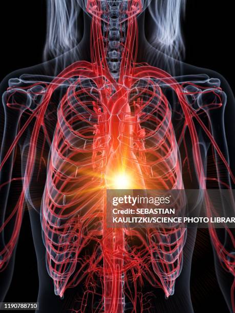 heart attack, conceptual illustration - woman heart attack stock illustrations