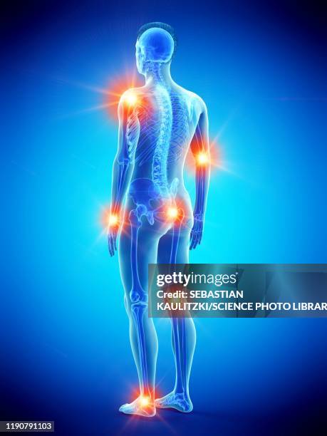 stockillustraties, clipart, cartoons en iconen met joint pain, conceptual illustration - shoulder joint