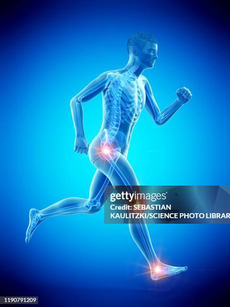 runner with joint pain, conceptual illustration - ankle exercise stock illustrations