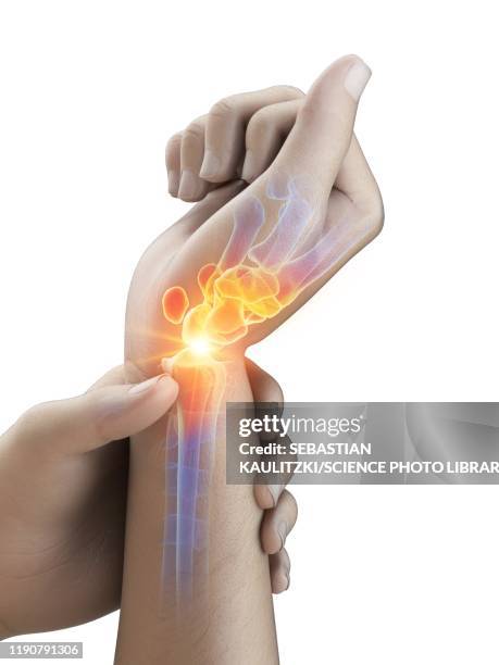 wrist pain, conceptual illustration - wrist stock illustrations