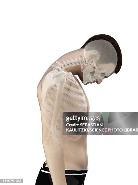Neck Anatomy Illustration High-Res Vector Graphic - Getty Images