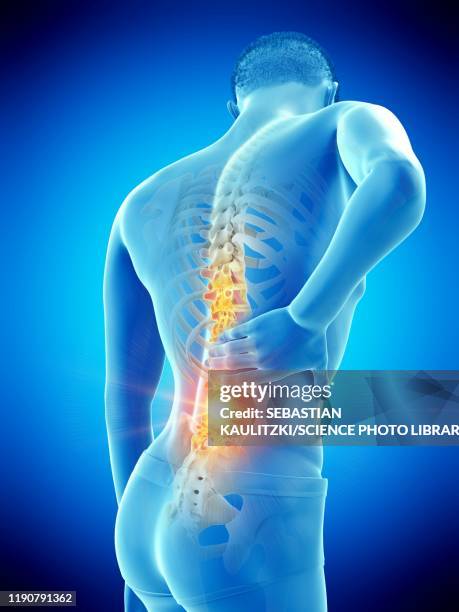 ilustrações de stock, clip art, desenhos animados e ícones de back pain, conceptual illustration - osteoporose