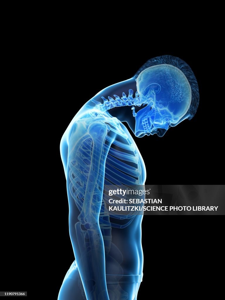 Neck Visual Neck Anatomy Illustration High-Res Vector Graphic - Getty Images