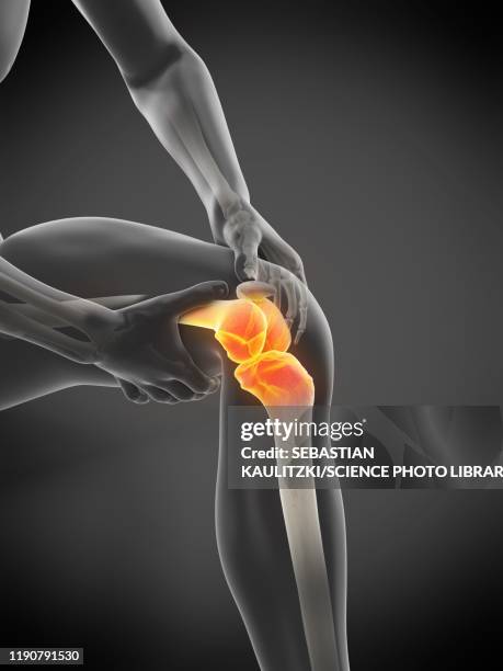 knee pain, conceptual illustration - rheumatism 幅插畫檔、美工圖案、卡通及圖標