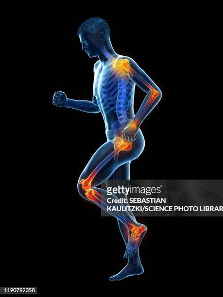 joint pain, conceptual illustration - hip body part stock illustrations