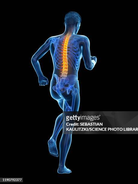 ilustraciones, imágenes clip art, dibujos animados e iconos de stock de back pain, conceptual illustration - human spine