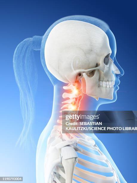 Open Neck Injuries 26 Neck Injury Woman High Res Illustrations - Getty Images