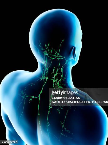 Vishochov Node Lymph Nodes In Back Of Neck
