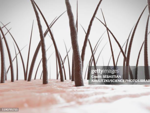 unhealthy human hair, illustration - scalp stock illustrations