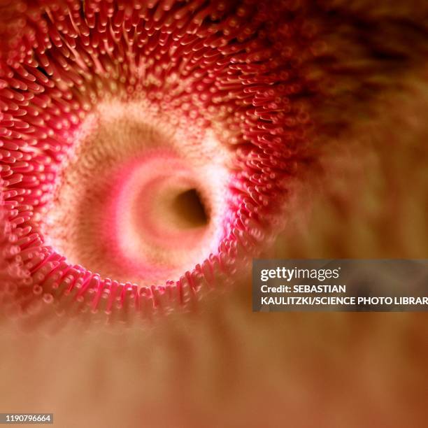 Intestinal Lining Rip 124 Intestinal Lining Stock Photos, High-Res Pictures, and Images ...