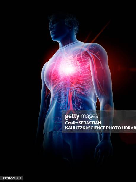 heart disease, conceptual illustration - myocardium stock-grafiken, -clipart, -cartoons und -symbole