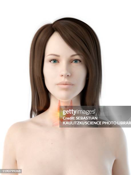 thyroid cancer, conceptual illustration - thyroid hormone stock illustrations