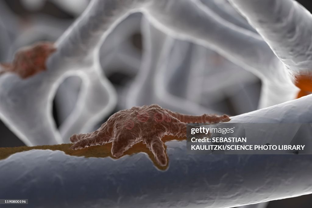 Osteoclast, illustration