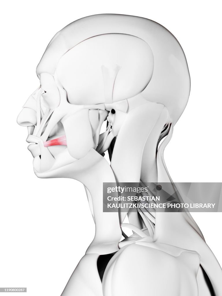 Risorius Injection Risorius