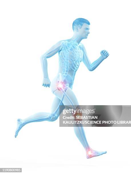 ilustraciones, imágenes clip art, dibujos animados e iconos de stock de runner with joint pain, conceptual illustration - hombre sensible