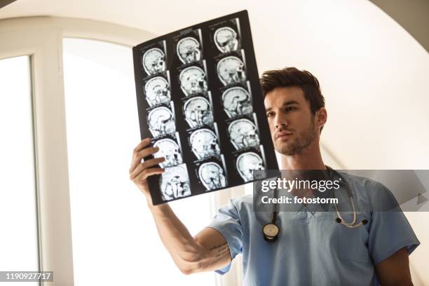 neurosurgeon analyzing mri scans of a brain tumor patient - skull xray no brain stock pictures, royalty-free photos & images