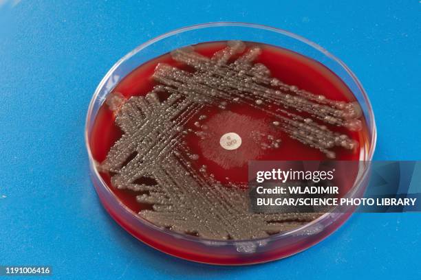 stool culture - bacteria cultures stock pictures, royalty-free photos & images