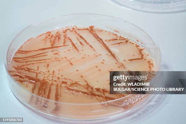 stool culture - bacteria cultures stock pictures, royalty-free photos & images