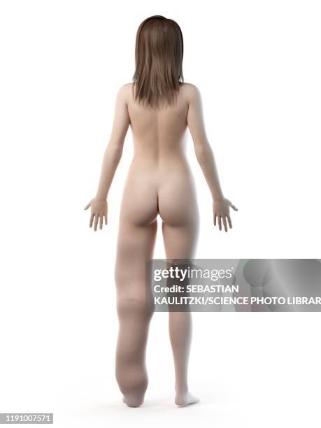 lymphoedema, illustration - lymphedema treatment stock illustrations