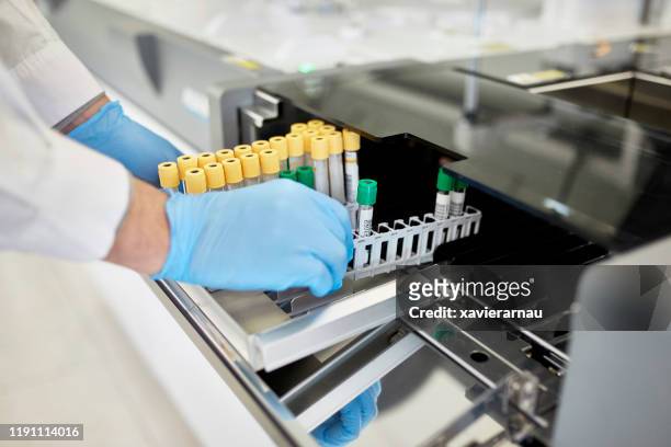 pathologe verarbeitet blutproben im testrohr-rack - immunologie stock-fotos und bilder
