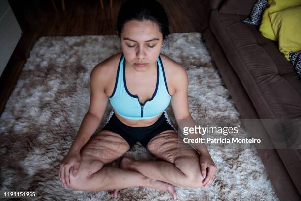 mulher praticando ioga na sala de sua casa, com suas cicatrizes à mostra - praticando stock-fotos und bilder