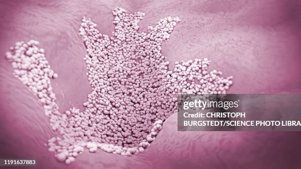 fungal skin infection, illustration - skin fungus stock illustrations